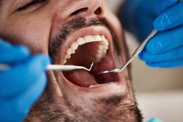 Best Tooth Infection Emergency Dentist  in Dawson Springs, KY
