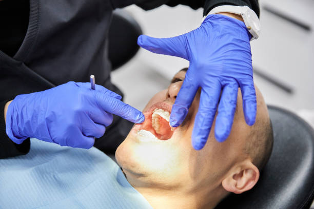 Best Dentist for Tooth Abscess  in Dawson Springs, KY